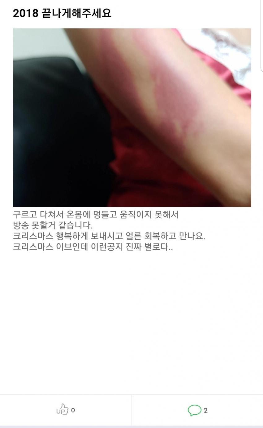 tnQD5Cx.jpg 실시간 여캠BJ들 상황