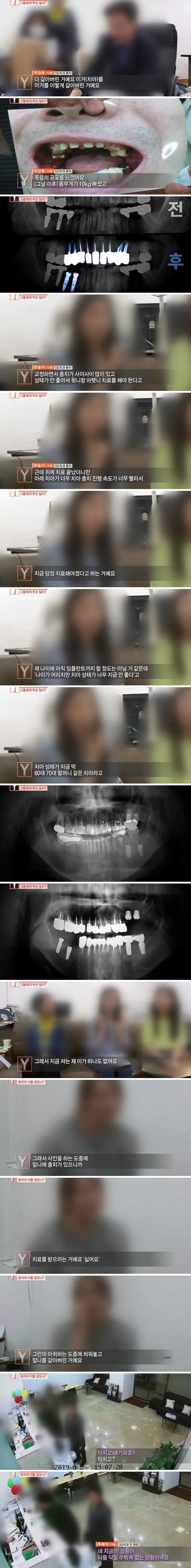 같은 치과의사들도 충격받았다는 진료사진.jpg